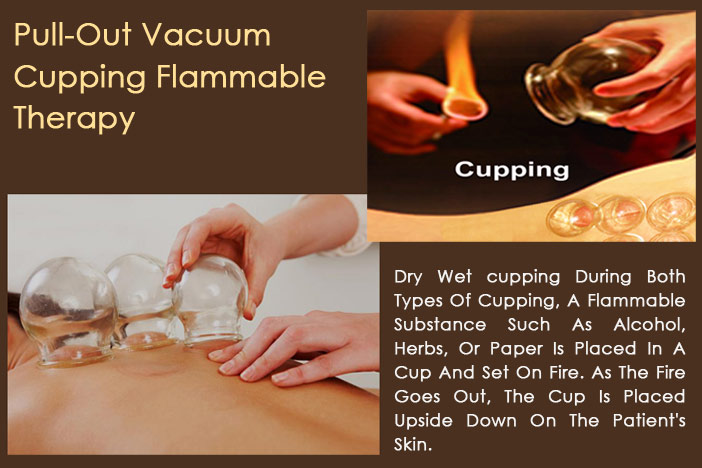 Pull-Out Vacuum Cupping Flammable Therapy Treatment Set 