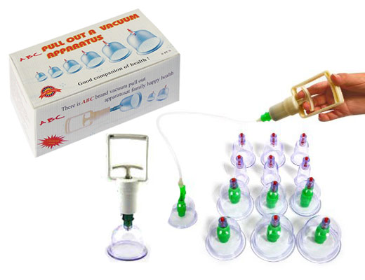 Shubh Surgical Supplier of Acupuncture Health Care Cupping Therapy Treatment Handle and Cups Set Equipment